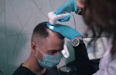 Пересадка волос для женщин: современные методы восстановления густоты и уверенности