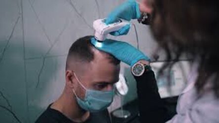 Пересадка волос для женщин: современные методы восстановления густоты и уверенности